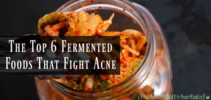 The Top 6 Fermented Foods That Fight Acne