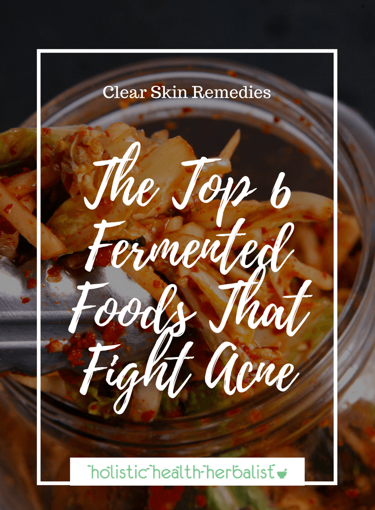The Top 6 Fermented Foods That Fight Acne - Learn about which fermented foods you can incorporate into your diet that will help fight acne from the inside out.