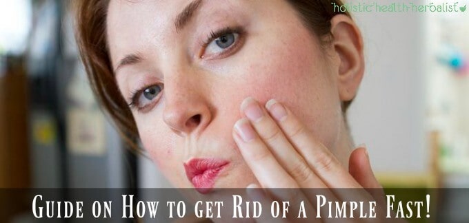 Learn How to get Rid of a Pimple Fast!