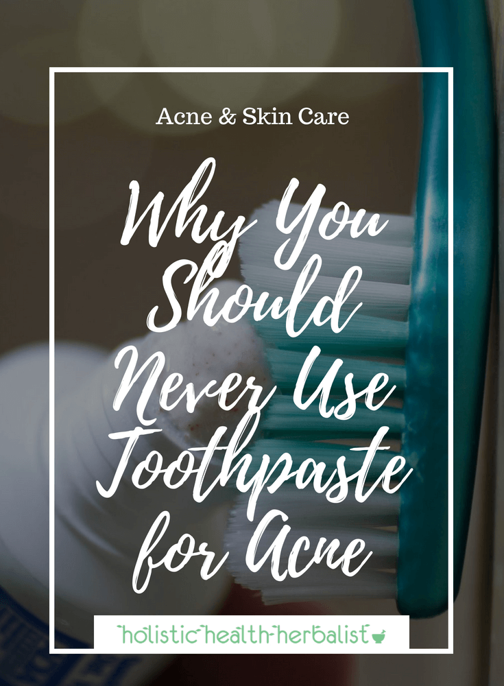 Why You Should Never Use Toothpaste for Acne - Learn how toothpaste can actually make your acne and scarring worse if used on blemishes.