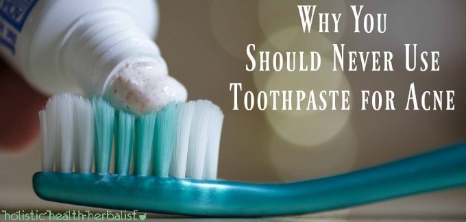 Why You Should Never Use Toothpaste for Acne