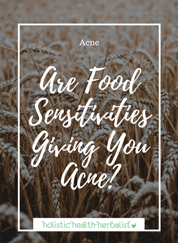 Are Food Sensitivities Giving You Acne? - Find out if your sensitivities and allergies are the root cause of your acne and how to avoid them!