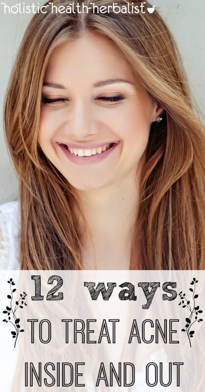 12 Ways to Treat Acne Inside and Out - Learn how to treat acne inside and out with chemical free ingredients that unclog pores, balance sebum, and beautify the skin while living healthy! 