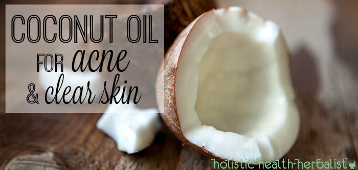 how to use coconut oil for acne and clear skin