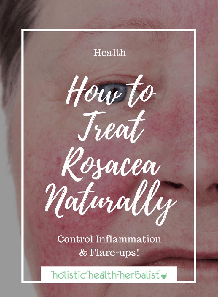 How to Treat Rosacea Naturally for Good! - Learn how to control inflammation and flare-ups so that you can alleviate the symptoms of rosacea. 