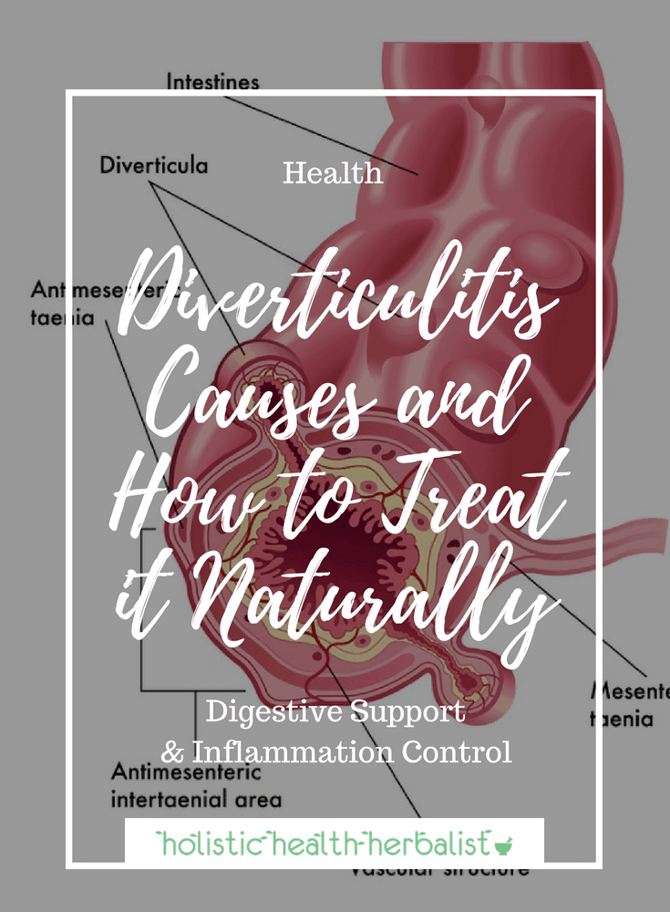 Diverticulitis Causes and How to Treat it Naturally - Learn about the best ways to prevent and treat diverticolosis and diverticulitis naturally through proper diet, supplementation, and the use of essential oils.